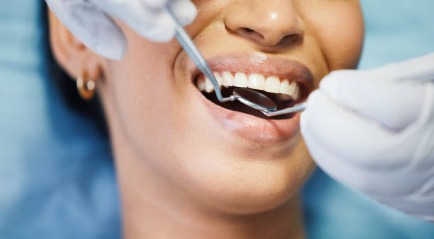 Best Emergency Wisdom Tooth Extraction in Maan, ND