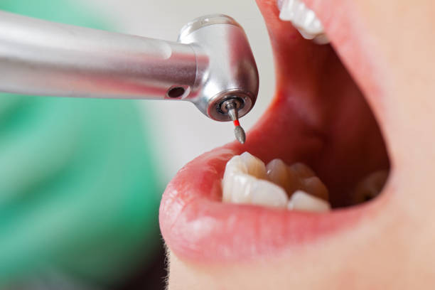 Best Emergency Treatment for Oral Infections in Maan, ND